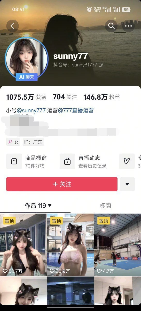 ✅抖音 sunny77/宝贝77-6 150万粉 大尺度骚舞+大尺度自拍等 图 01
